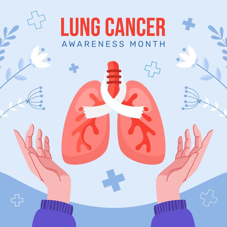 Understanding the Stages of Lung Cancer: What You Need to Know